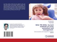 Buchcover von SEAL THE DEAL: Current methods of caries excavation and management