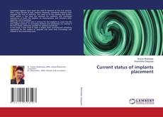 Copertina di Current status of implants placement