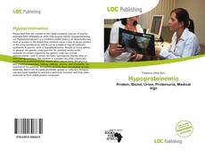 Copertina di Hypoproteinemia