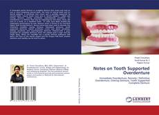 Copertina di Notes on Tooth Supported Overdenture