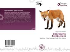 Lipoatrophia Semicircularis的封面