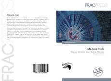 Bookcover of Macular Hole