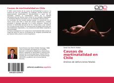 Causas de mortinatalidad en Chile kitap kapağı
