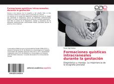 Formaciones quísticas intracraneales durante la gestación的封面