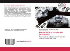 Prevención a través del periodonto的封面