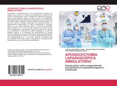 APENDICECTOMÍA LAPAROSCÓPICA AMBULATORIA的封面