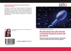 Positividad de p30 desde el hecho hasta la toma de muestra的封面