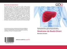 Bookcover of Síndrome de Budd-Chiari