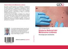 Bookcover of Historia Natural del Melanoma cutáneo