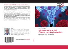 Bookcover of Historia natural del Cáncer de cérvix uterino