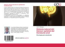 Historia natural del Cáncer epitelial del Conducto anal的封面