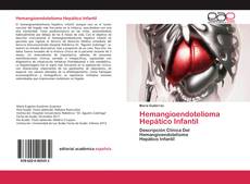 Bookcover of Hemangioendotelioma Hepático Infantil