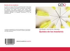 Couverture de Quistes de los maxilares