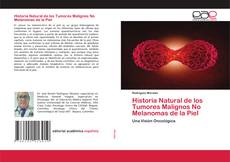Couverture de Historia Natural de los Tumores Malignos No Melanomas de la Piel