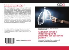 Buchcover von Evolución clínica e imagenológica de pacientes con cáncer de pulmón