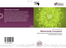 Portada del libro de Whole-body Transplant