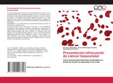Buchcover von Presentación infrecuente de cáncer basocelular