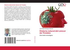Copertina di Historia natural del cáncer de Tiroides