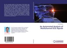 Couverture de An Automated Analysis of Multichannel ECG Signals