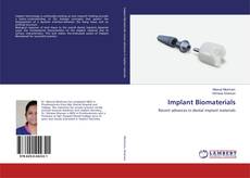 Buchcover von Implant Biomaterials