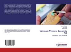 Bookcover of Laminate Veneers: Science & Art