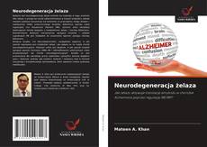 Copertina di Neurodegeneracja żelaza