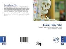 Copertina di Central Facial Palsy