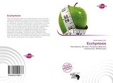 Bookcover of Ecchymosis