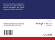 Capa do livro de Peri-Implant Diseases 