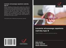 Couverture de Leczenie wirusowego zapalenia wątroby typu B