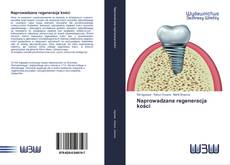 Capa do livro de Naprowadzana regeneracja kości 