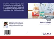 Capa do livro de Peri-Implantitis 