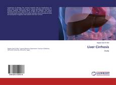 Bookcover of Liver Cirrhosis