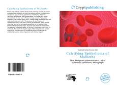 Bookcover of Calcifying Epithelioma of Malherbe