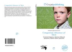 Bookcover of Congenital Absence of Skin