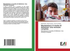 Buchcover von Montelukast e il morbo di Alzheimer: Una revisione completa