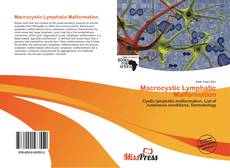 Bookcover of Macrocystic Lymphatic Malformation