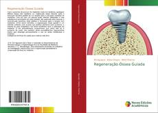Borítókép a  Regeneração Óssea Guiada - hoz