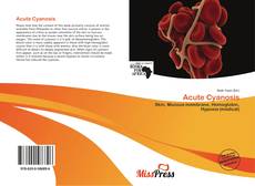 Bookcover of Acute Cyanosis