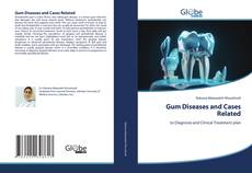 Bookcover of Gum Diseases and Cases Related