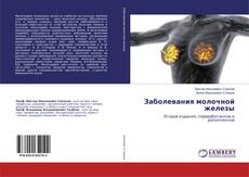 Bookcover of Заболевания молочной железы