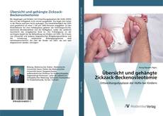 Bookcover of Übersicht und gehängte Zickzack-Beckenosteotomie