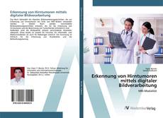 Copertina di Erkennung von Hirntumoren mittels digitaler Bildverarbeitung