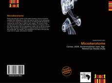 Bookcover of Microkeratome