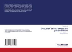Couverture de Occlusion and its effects on periodontium