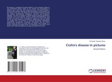 Portada del libro de Crohn's disease in pictures