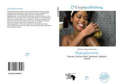 Bookcover of Hypoglycemia