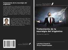 Bookcover of Tratamiento de la neuralgia del trigémino