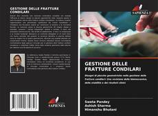 Bookcover of GESTIONE DELLE FRATTURE CONDILARI