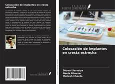 Capa do livro de Colocación de implantes en cresta estrecha 